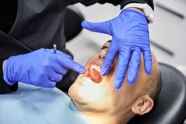 Best Emergency Gum Pain Relief  in Marlette, MI